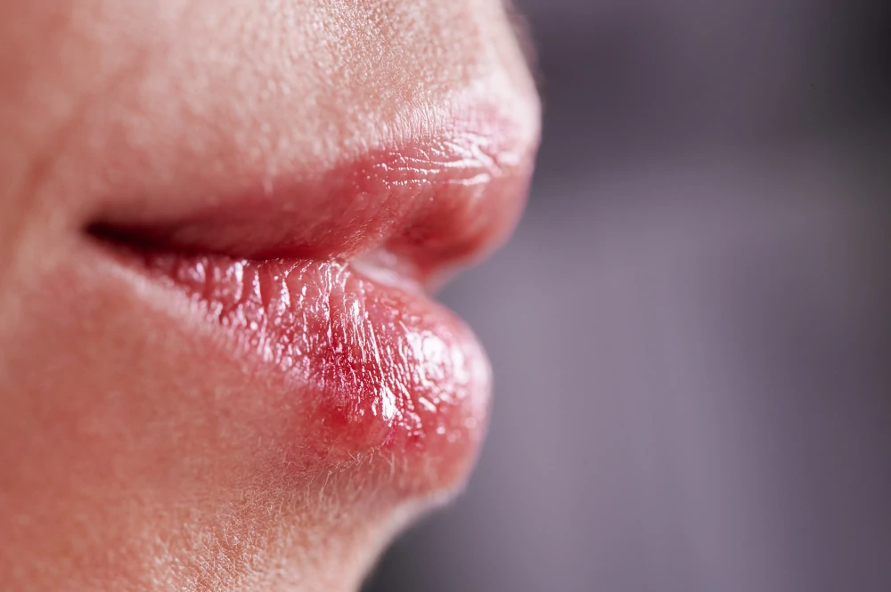 Relazione tra herpes e trucco semipermanente labbra