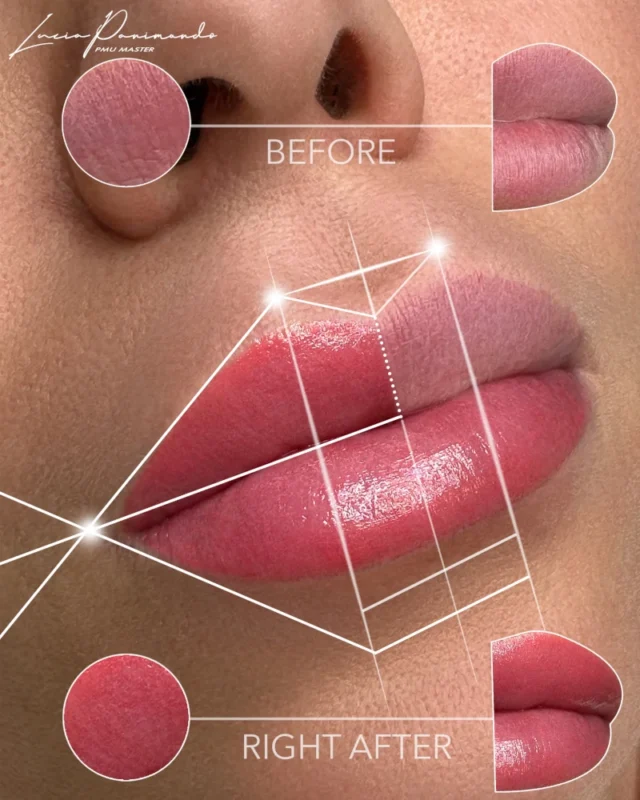 Labbra asimmetriche: Filler labbra e trucco permanente come soluzione