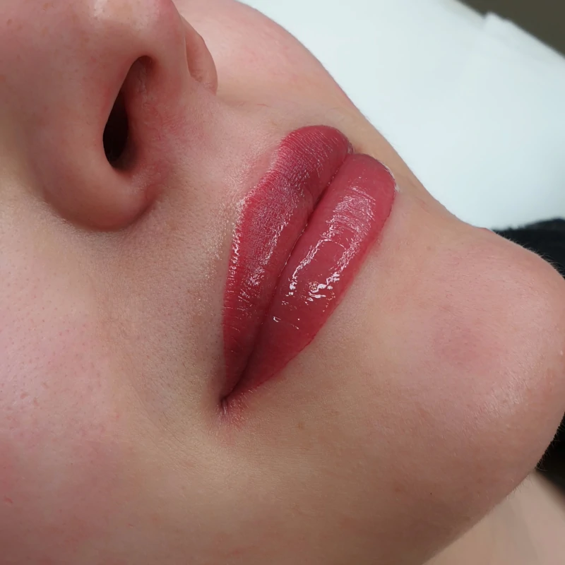 Lividi dopo trattamento pmu labbra