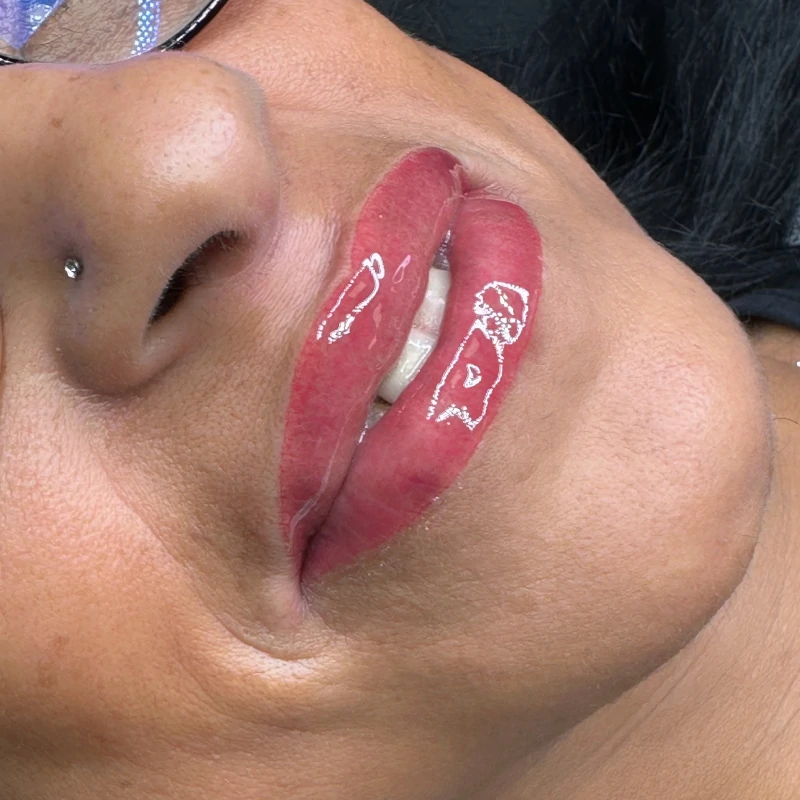 I lividi dopo tatuaggio alle labbra