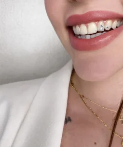 Corso online gemme dentali